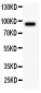 Anti-ATF6 Antibody